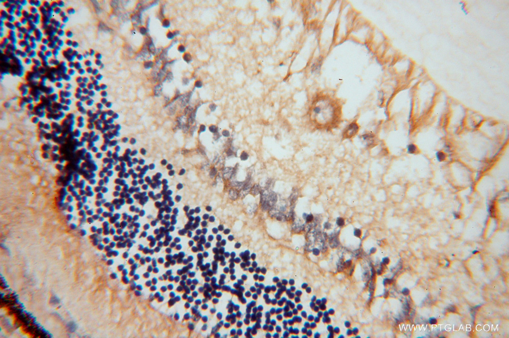 AIPL1 Polyclonal antibody