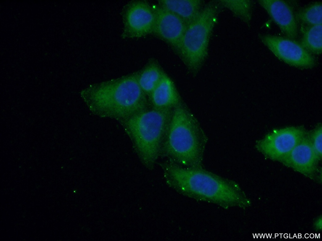 NSDHL Polyclonal antibody