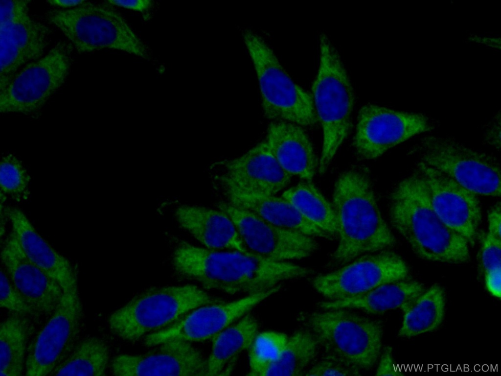 CAPRIN1 Polyclonal antibody