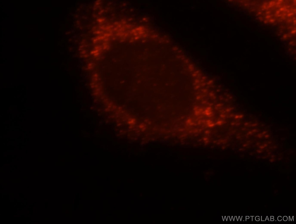 HSD17B4 Polyclonal antibody