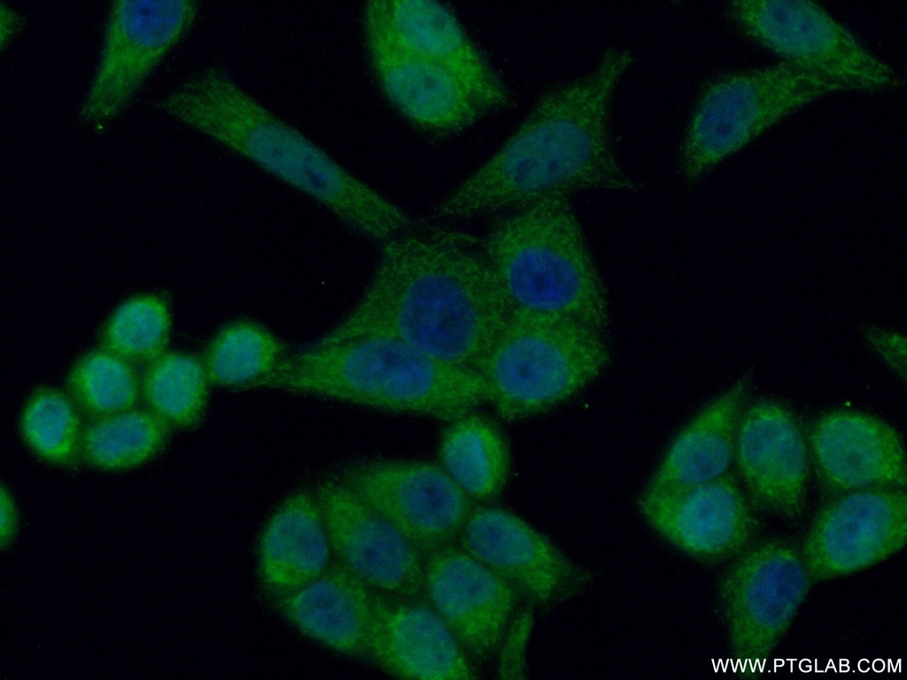 HCCS Polyclonal antibody