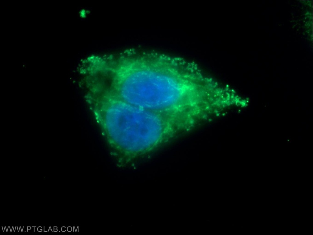 METTL9 Polyclonal antibody