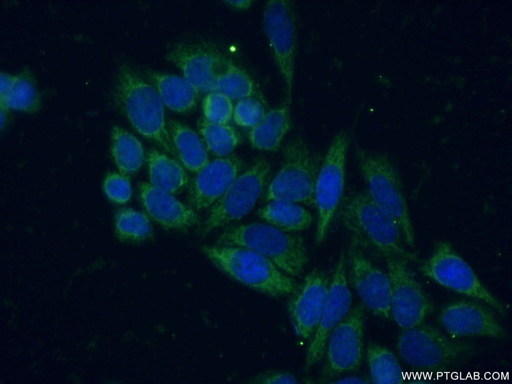 SIRT5 Polyclonal antibody