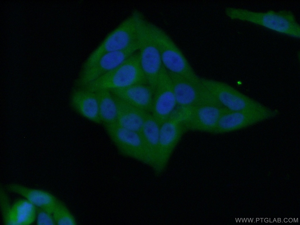 NNMT Polyclonal antibody