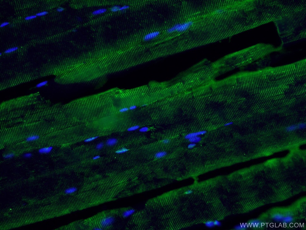 ABLIM1 Polyclonal antibody
