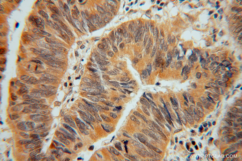 ADI1 Polyclonal antibody