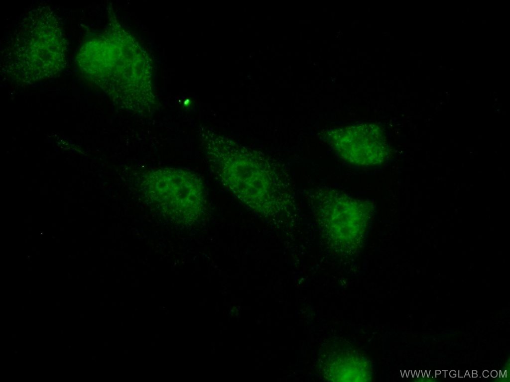 PPIL1 Polyclonal antibody