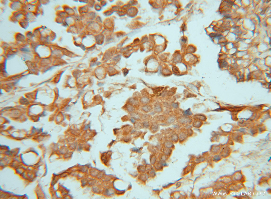 PIGK Polyclonal antibody