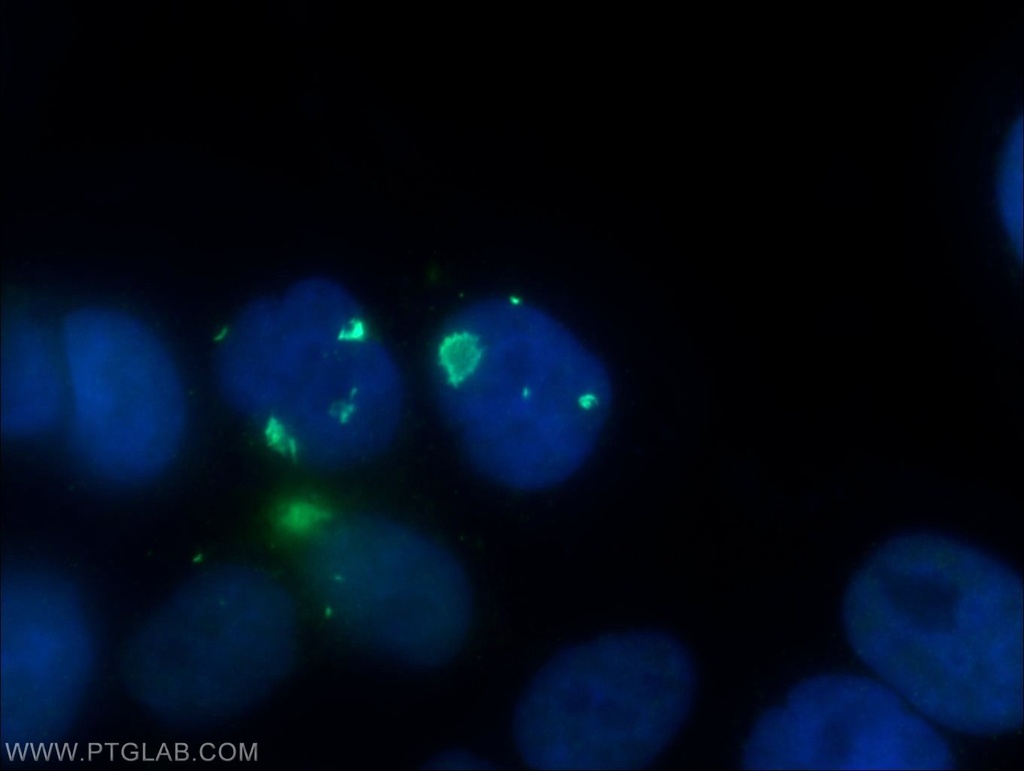 PSMB2 Polyclonal antibody