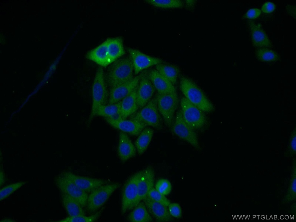 SARS Polyclonal antibody