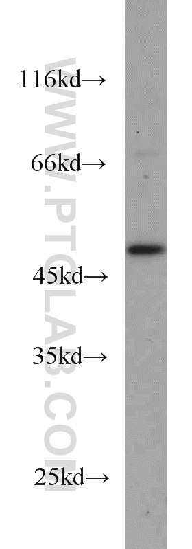 GALK2 Polyclonal antibody