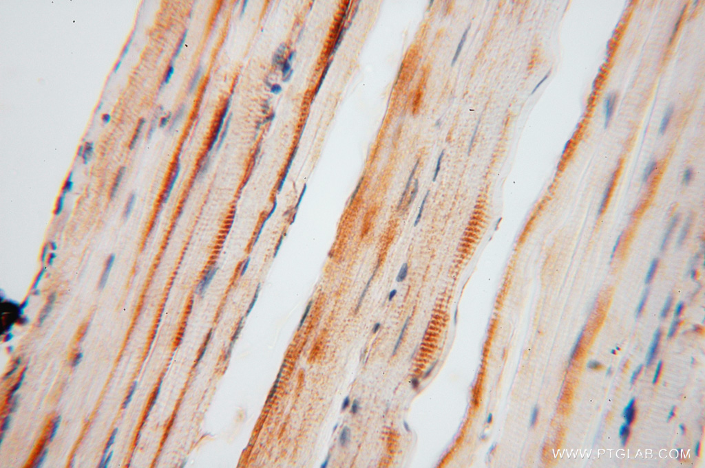 FEM1A Polyclonal antibody