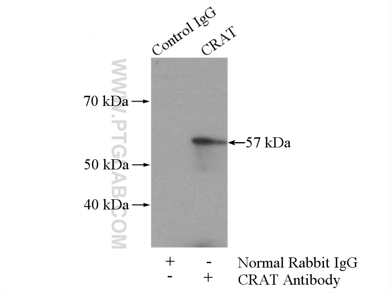 CRAT Polyclonal antibody