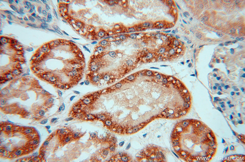 NDUFAF1 Polyclonal antibody