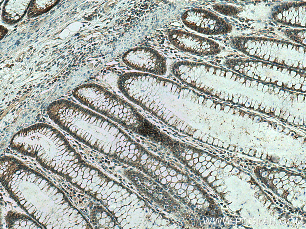 PRL3 Polyclonal antibody