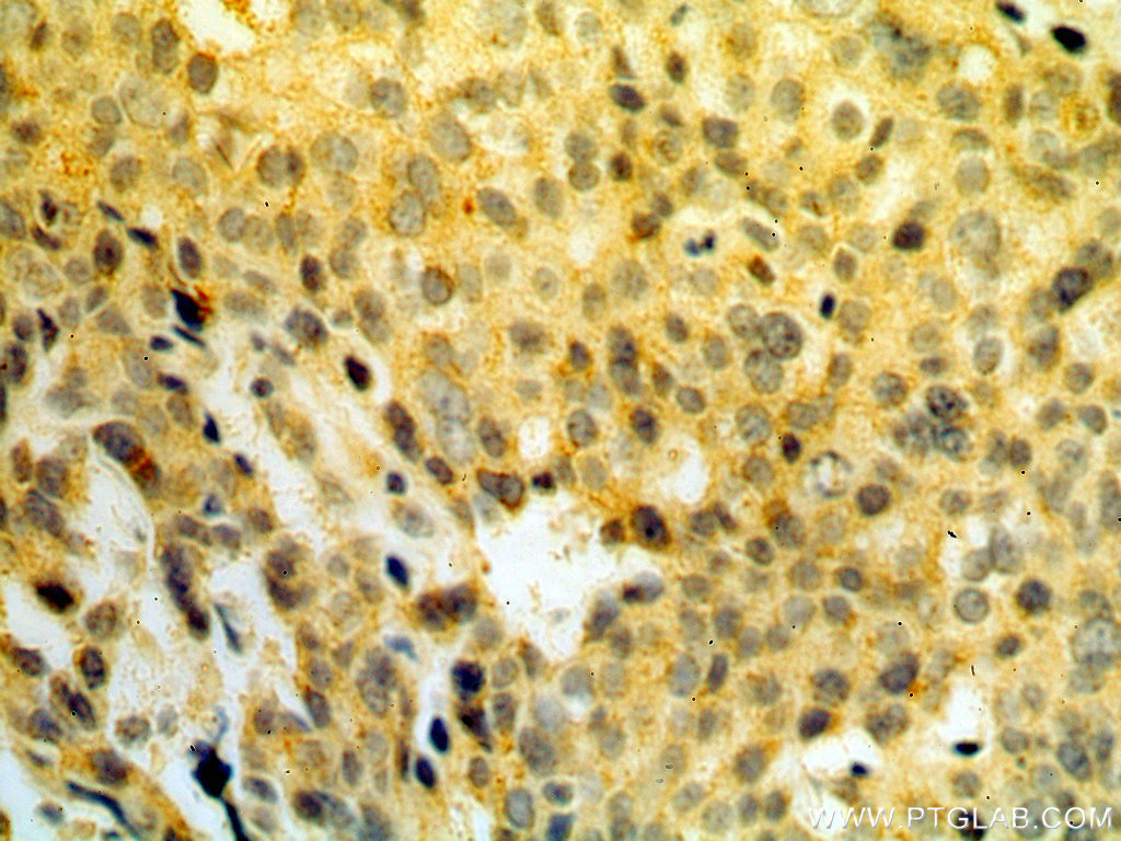 RPS3 Polyclonal antibody