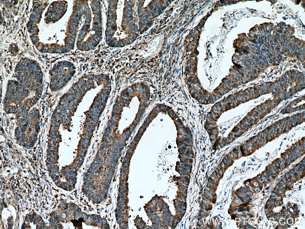 CNPY3 Polyclonal antibody