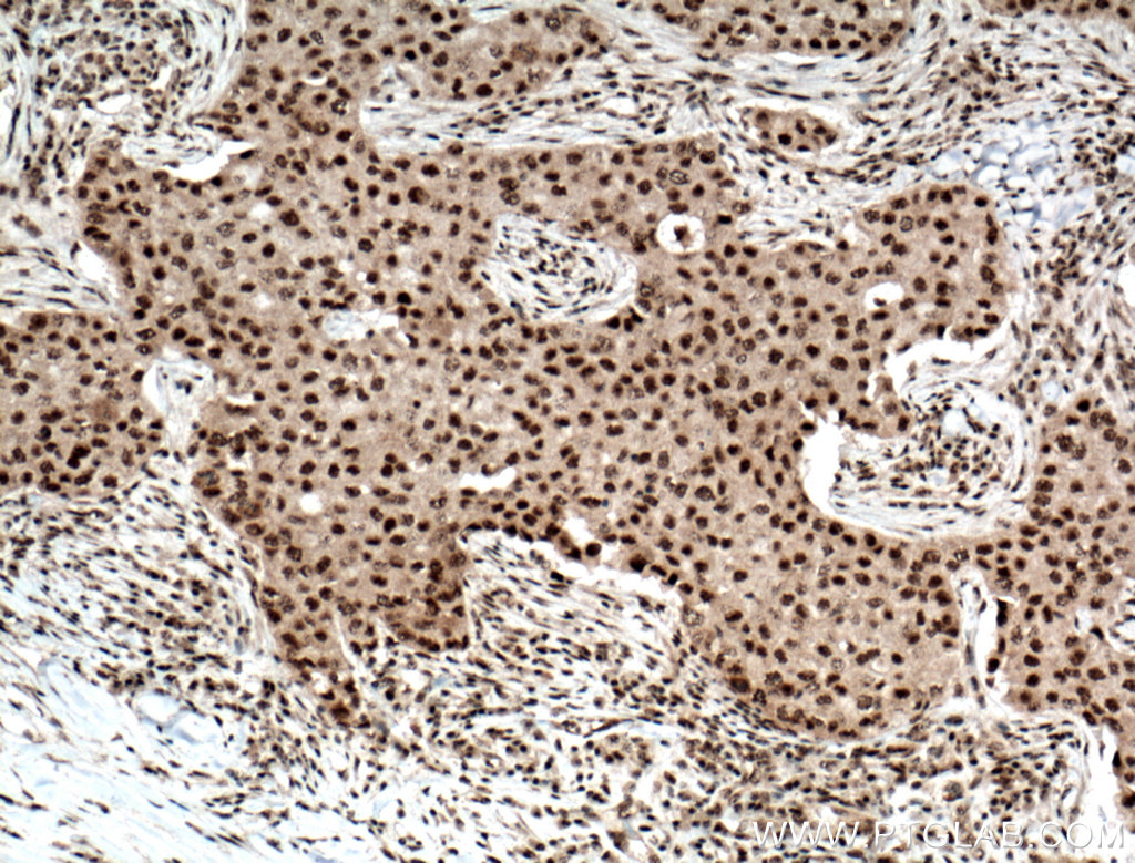 RPB5 Polyclonal antibody