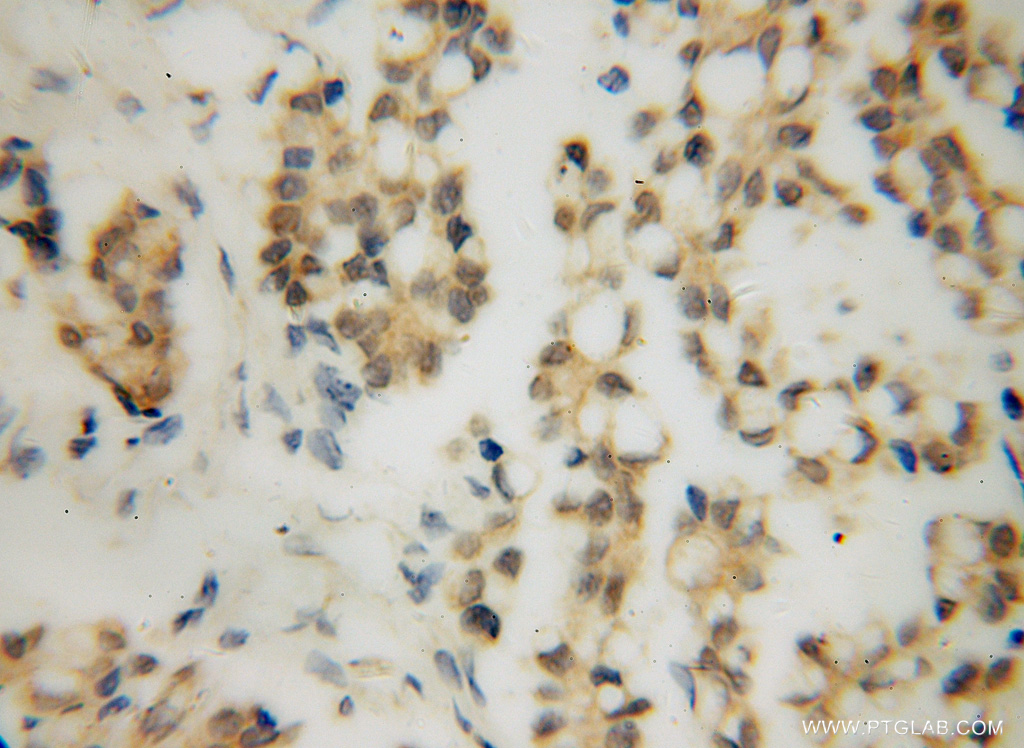 RPAIN Polyclonal antibody