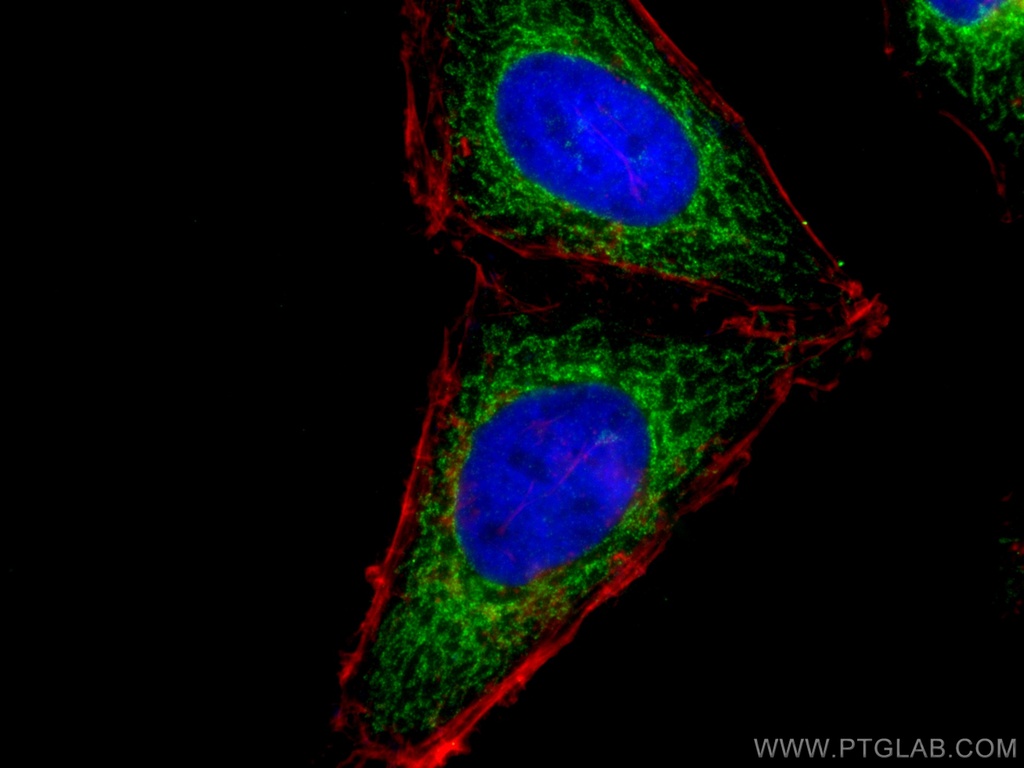 SLC25A1 Polyclonal antibody