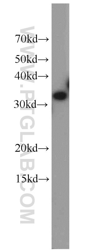 ESD Polyclonal antibody