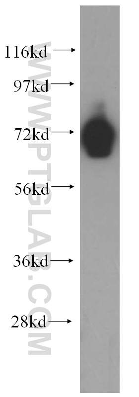 PCDHB5 Polyclonal antibody