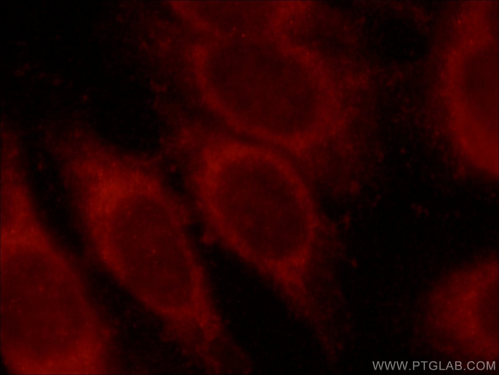 MLYCD Polyclonal antibody