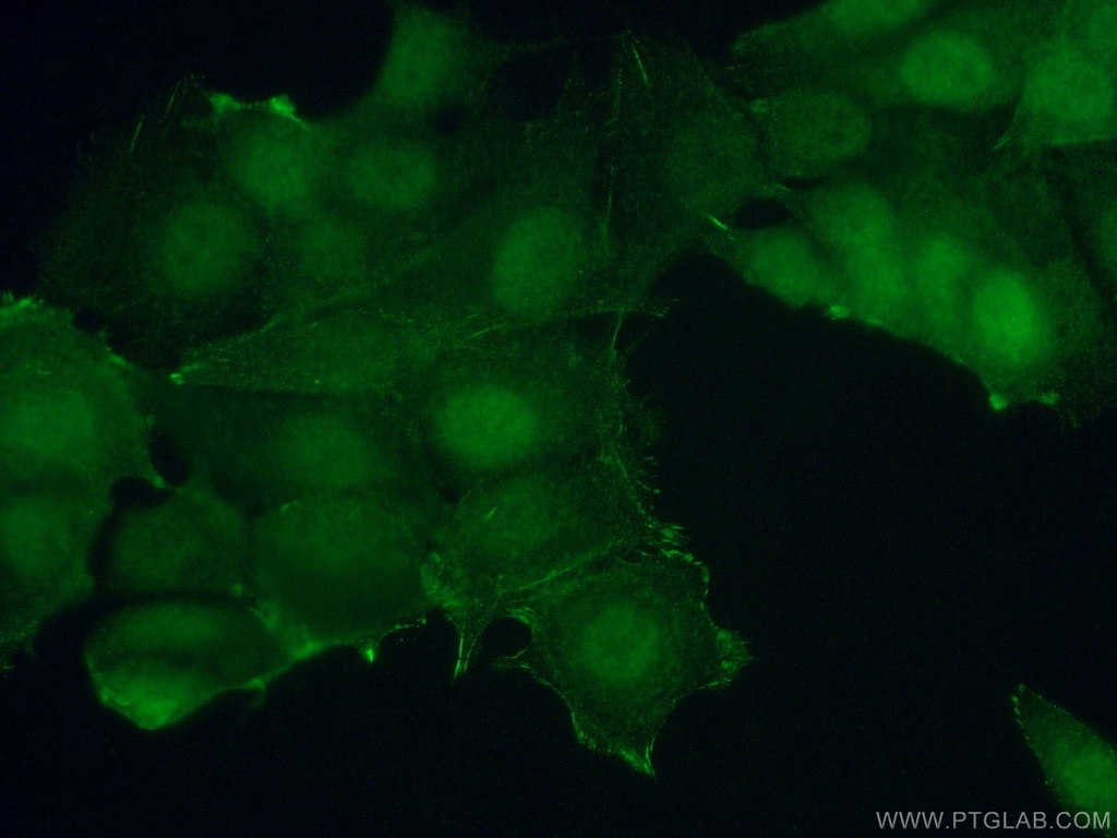 S6K2 Polyclonal antibody