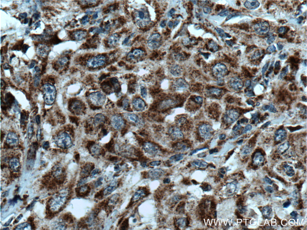 DHRS4 Polyclonal antibody