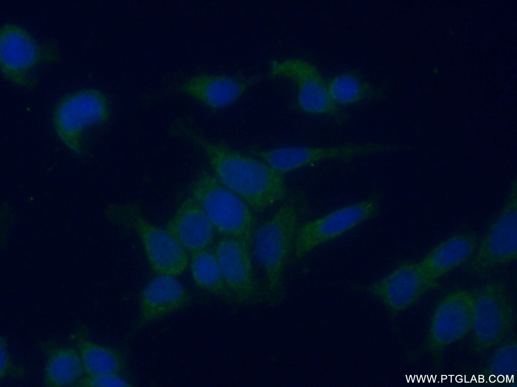 GALK1 Polyclonal antibody