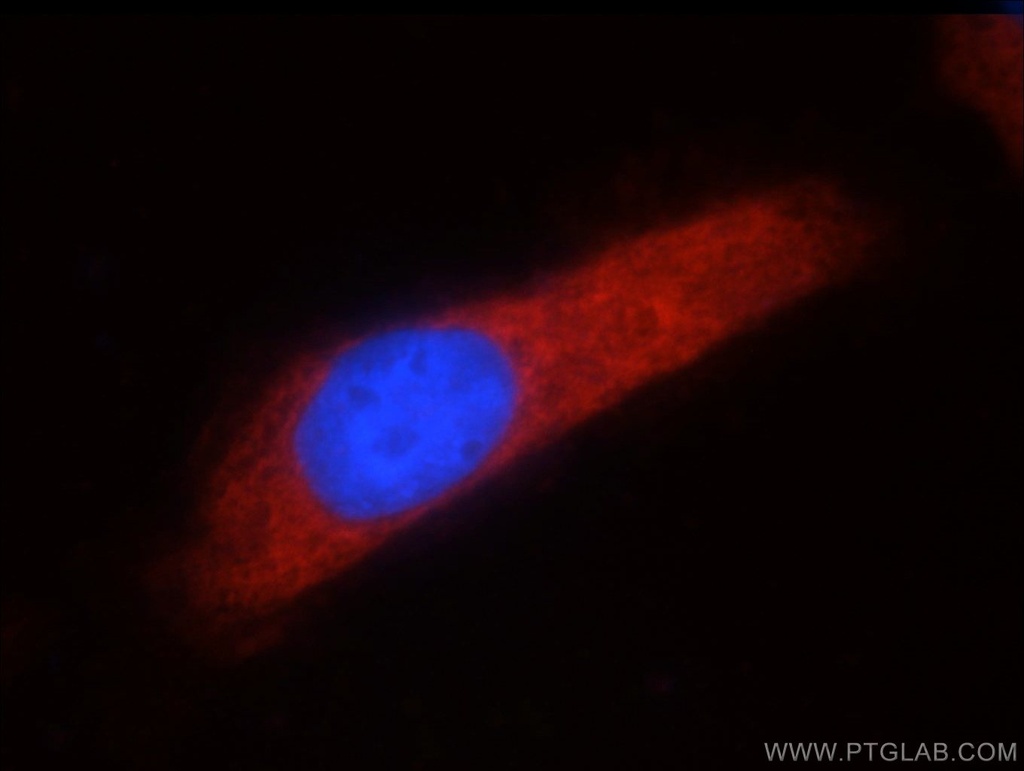 ARFGAP3 Polyclonal antibody