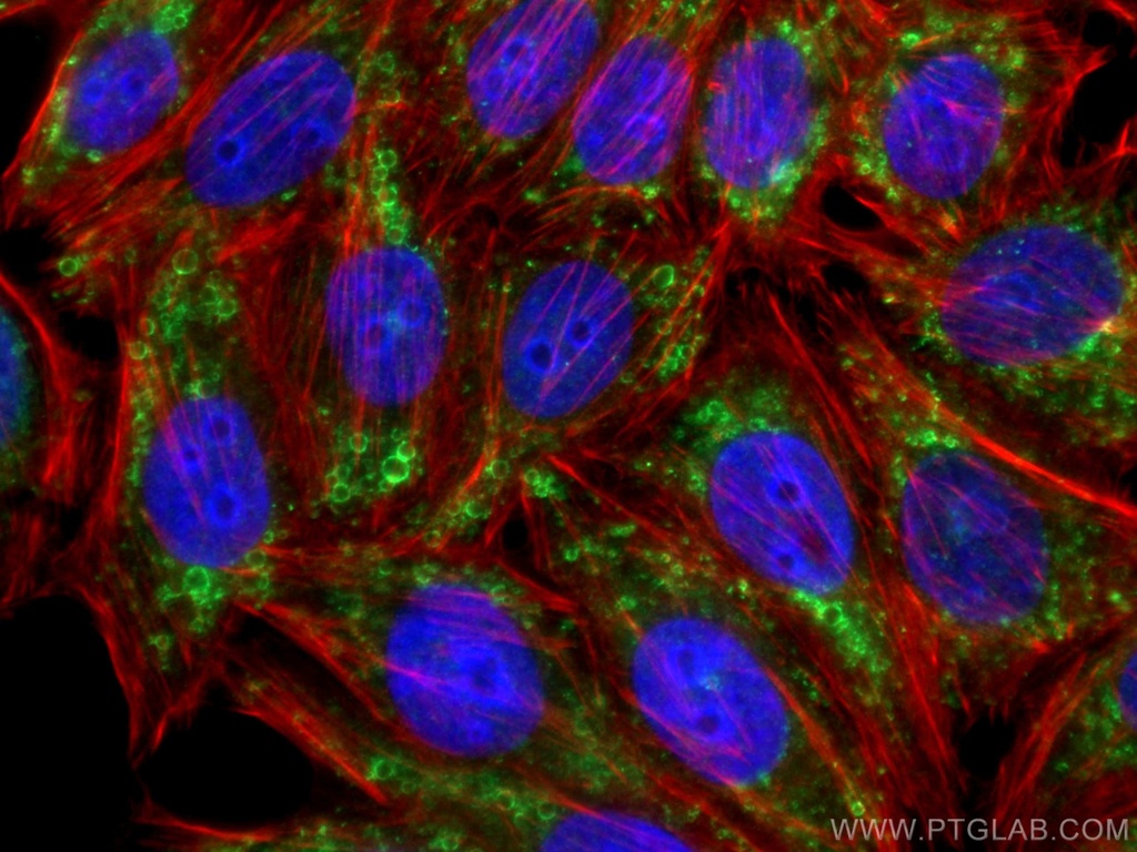 ADRP/Perilipin 2 Polyclonal antibody