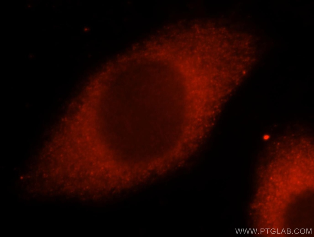 CARS Polyclonal antibody