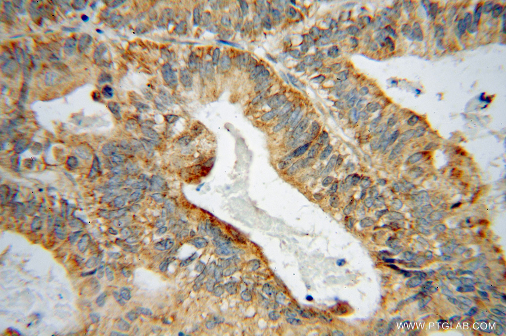 GRB14 Polyclonal antibody