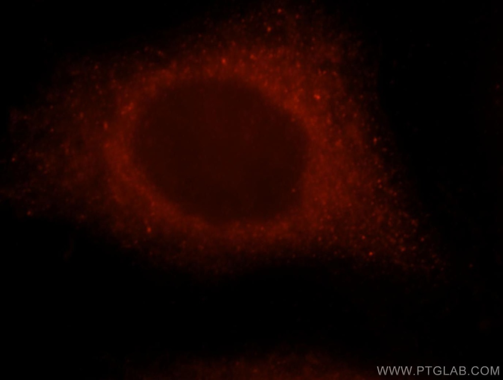 GBP1 Polyclonal antibody