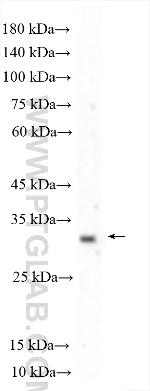 TSPAN14 Polyclonal antibody