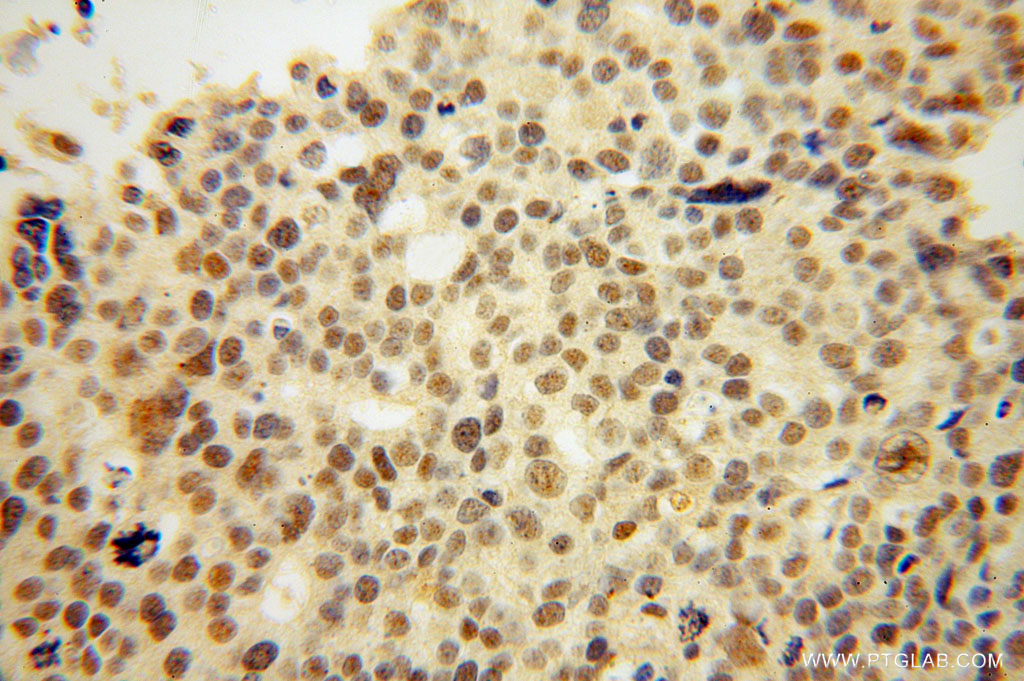 THOC6 Polyclonal antibody