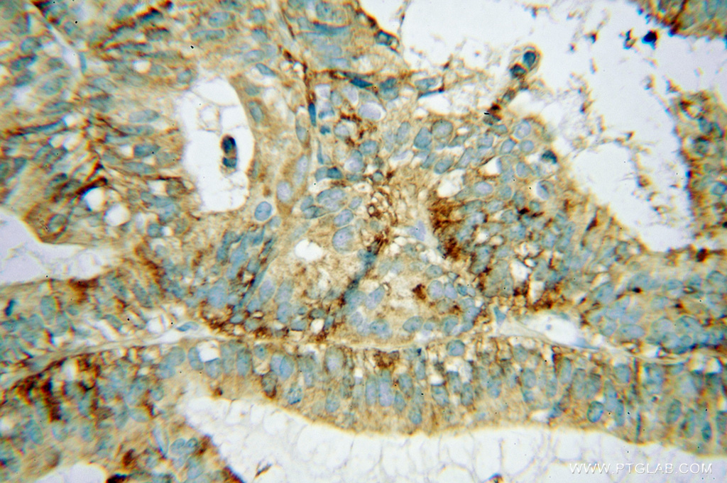 AP3S2 Polyclonal antibody