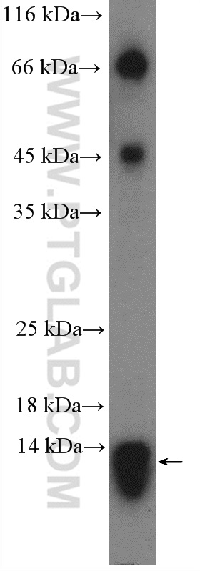 PAM16 Polyclonal antibody