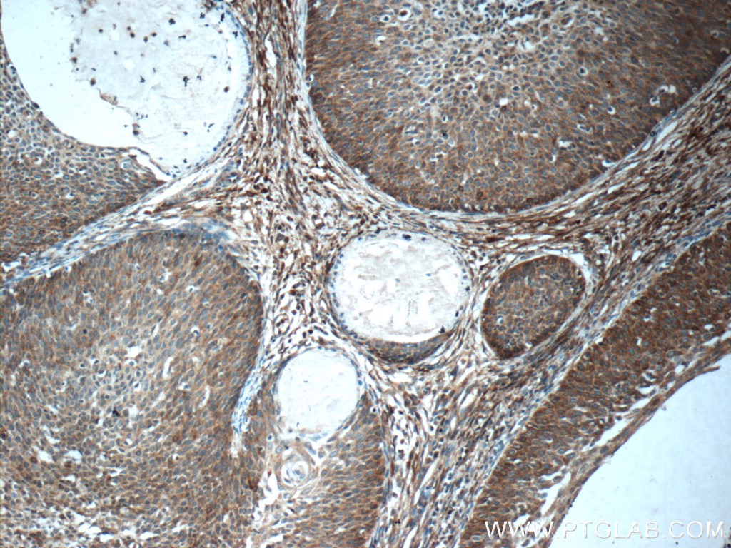 SFRP4 Polyclonal antibody
