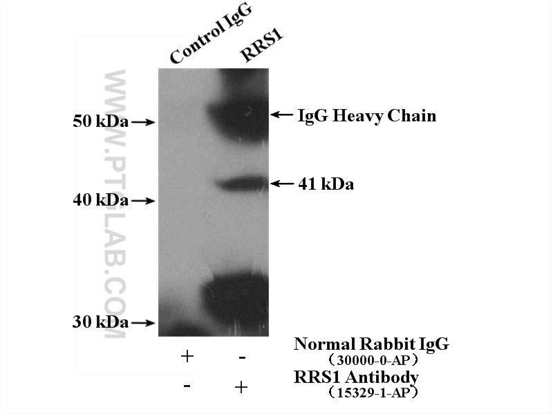 RRS1 Polyclonal antibody