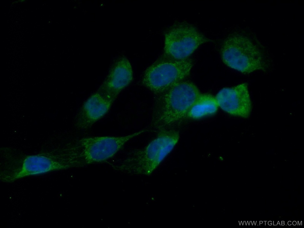 MVD Polyclonal antibody