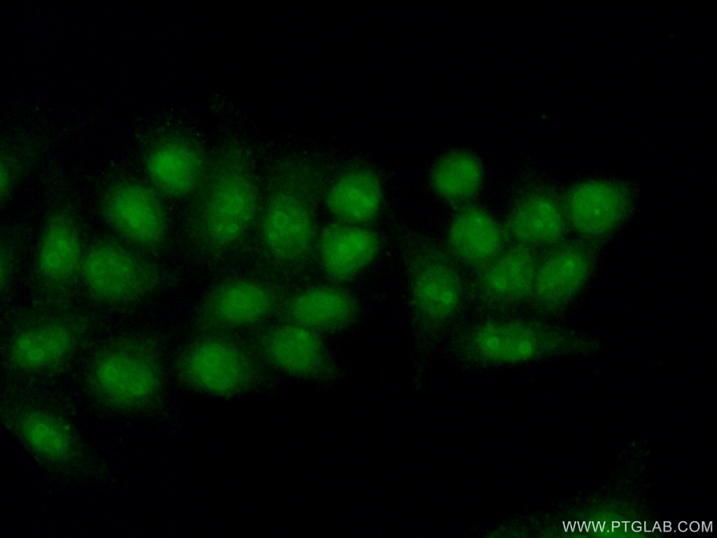 POLR3D Polyclonal antibody