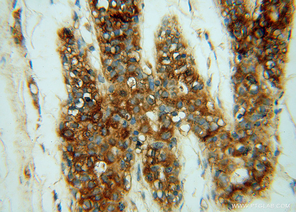 CHST12 Polyclonal antibody