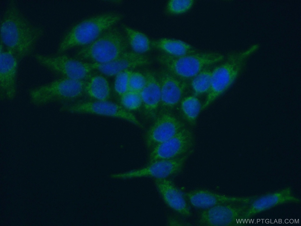CRIP1 Polyclonal antibody
