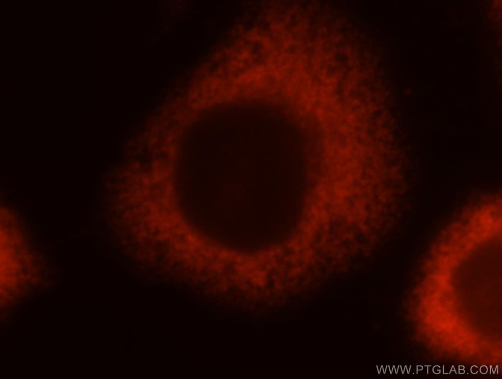 MYL9 Polyclonal antibody