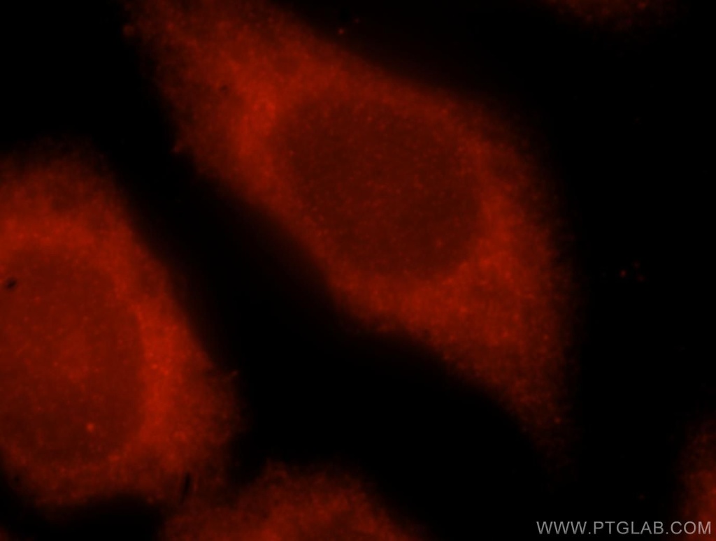 SNUPN Polyclonal antibody