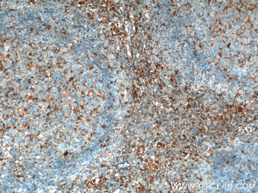 Beta Arrestin 1 Polyclonal antibody