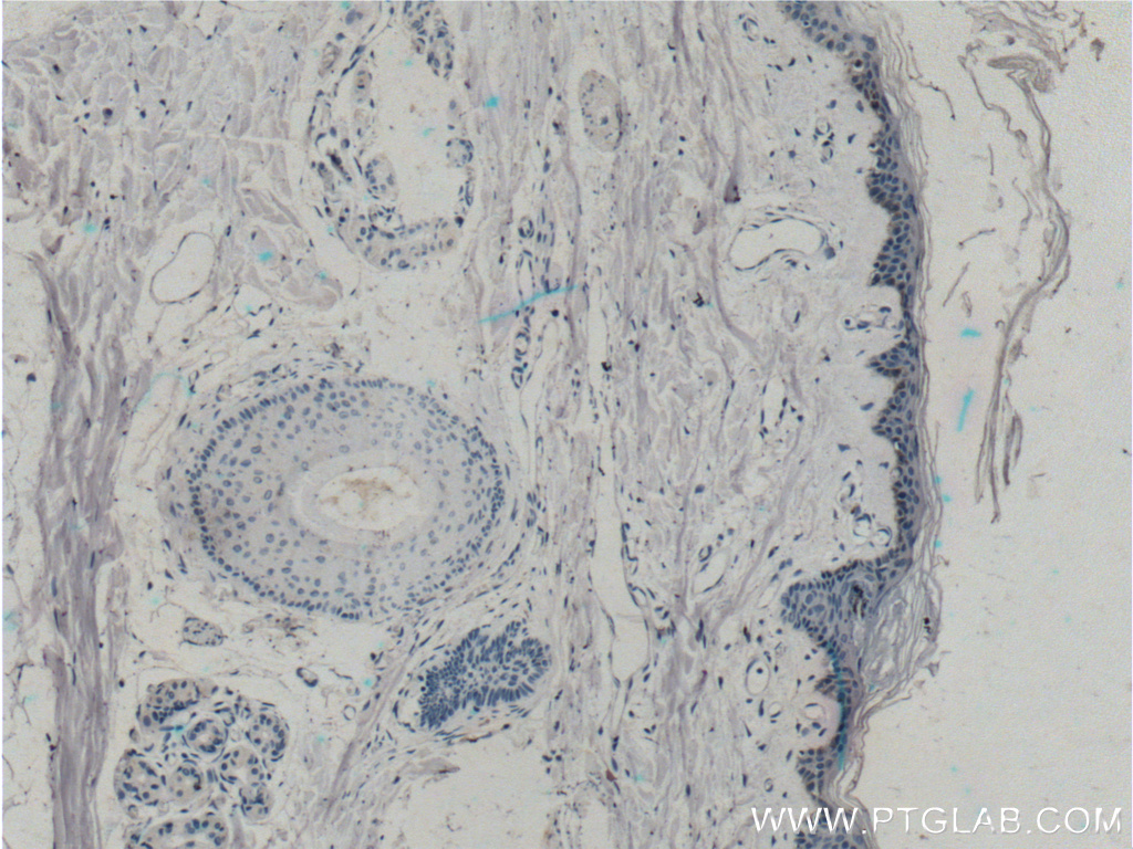ST6GALNAC1 Polyclonal antibody