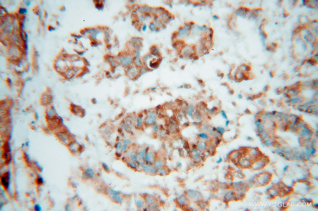 SPTLC1 Polyclonal antibody